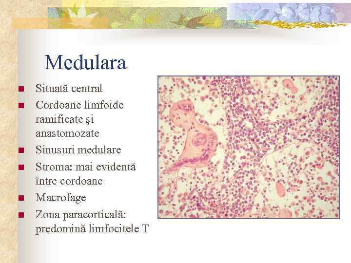 Medulara n n n Situată central Cordoane limfoide ramificate şi anastomozate Sinusuri medulare Stroma: