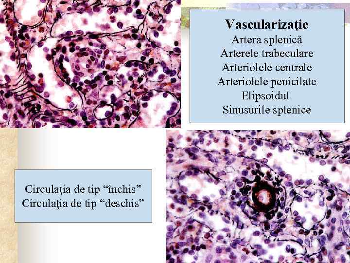 Vascularizaţie Artera splenică Arterele trabeculare Arteriolele centrale Arteriolele penicilate Elipsoidul Sinusurile splenice Circulaţia de