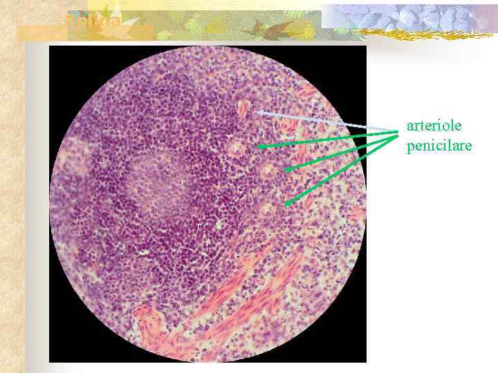 Splina arteriole penicilare 