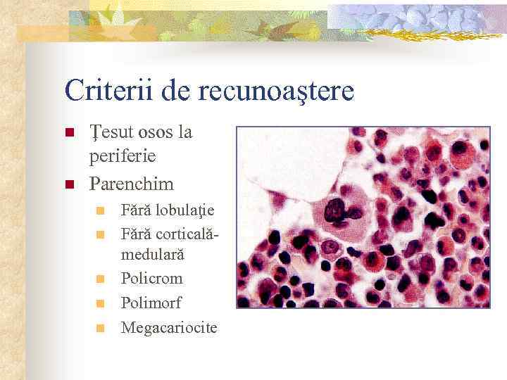 Criterii de recunoaştere n n Ţesut osos la periferie Parenchim n n n Fără