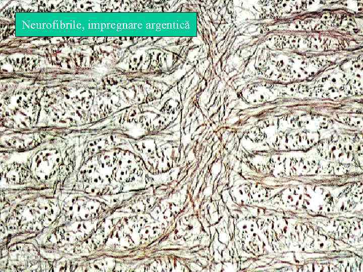 Neurofibrile, impregnare argentică 