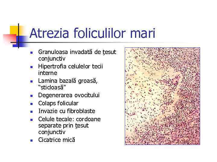 Atrezia foliculilor mari n n n n Granuloasa invadată de ţesut conjunctiv Hipertrofia celulelor