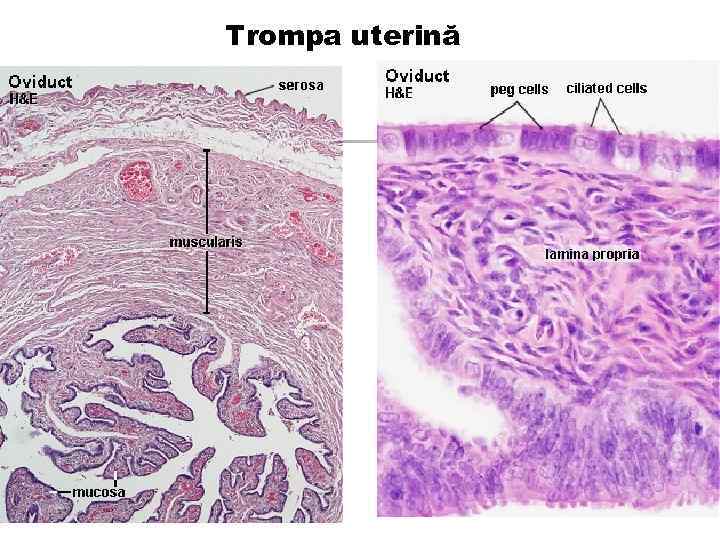 Trompa uterină 