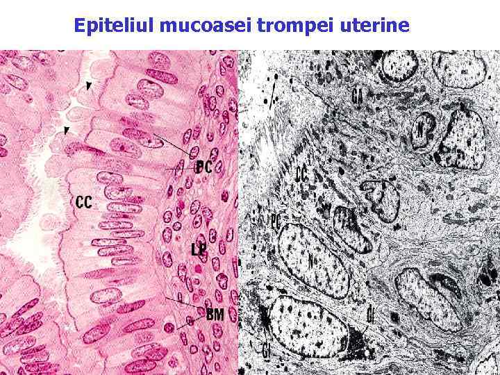 Epiteliul mucoasei trompei uterine 