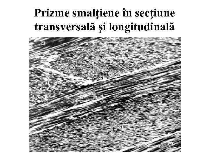 Prizme smalţiene în secţiune transversală şi longitudinală 