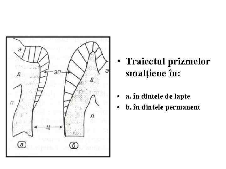  • Traiectul prizmelor smalţiene în: • a. în dintele de lapte • b.