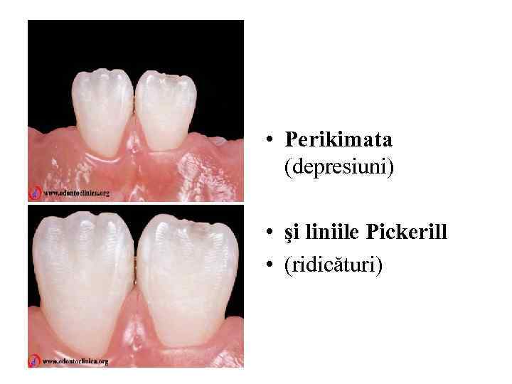  • Perikimata (depresiuni) • şi liniile Pickerill • (ridicături) 