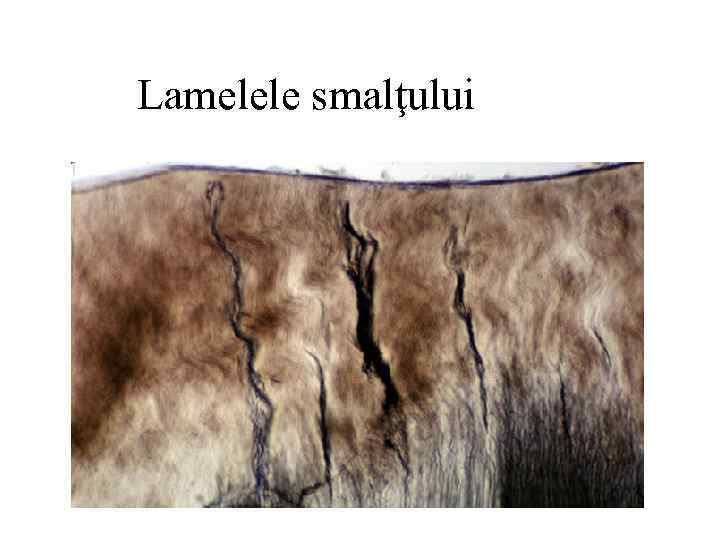 Lamelele smalţului 