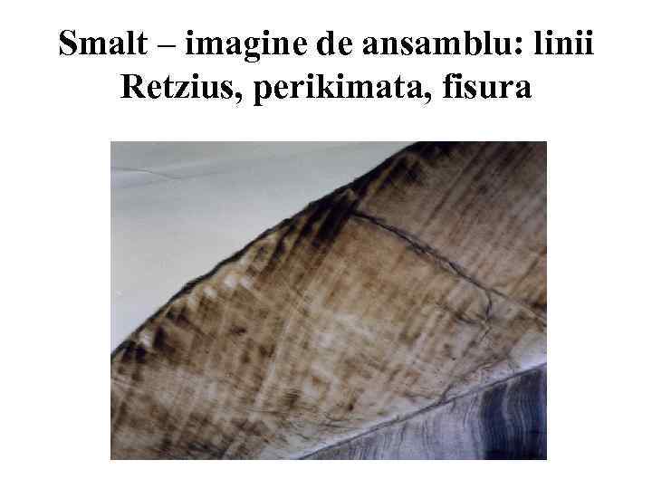 Smalt – imagine de ansamblu: linii Retzius, perikimata, fisura 