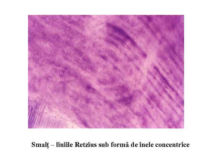 Smalţ – liniile Retzius sub formă de inele concentrice 