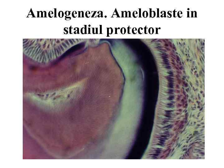 Amelogeneza. Ameloblaste in stadiul protector 