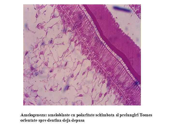 Amelogeneza: ameloblaste cu polaritate schimbata si prelungiri Tomes orientate spre dentina deja depusa 