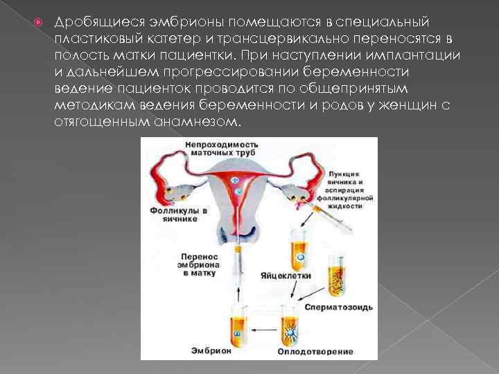 Подсадка эмбриона в матку