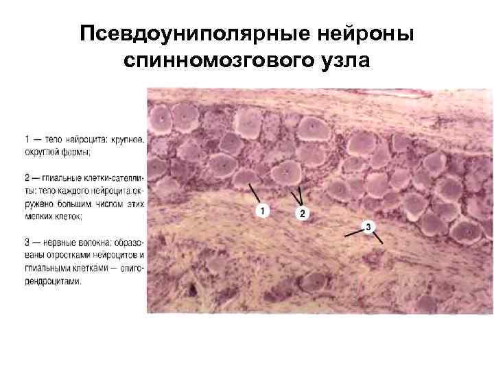 Псевдоуниполярные нейроны спинномозгового узла 