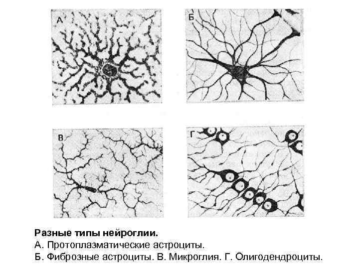 Разные типы нейроглии. А. Протоплазматические астроциты. Б. Фиброзные астроциты. В. Микроглия. Г. Олигодендроциты. 