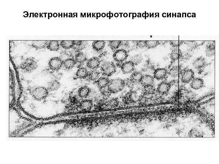 Электронная микрофотография синапса 