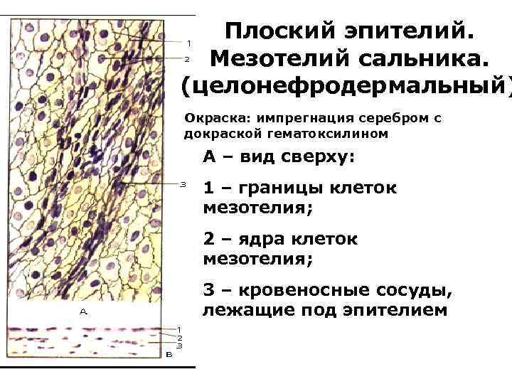 Плоский эпителий. Мезотелий сальника. (целонефродермальный) Окраска: импрегнация серебром с докраской гематоксилином. А – вид