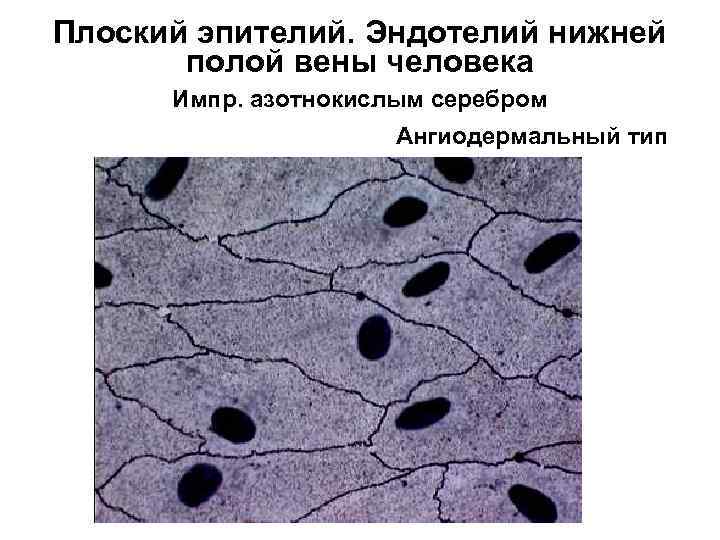 Плоский эпителий. Эндотелий нижней полой вены человека Импр. азотнокислым серебром Ангиодермальный тип 