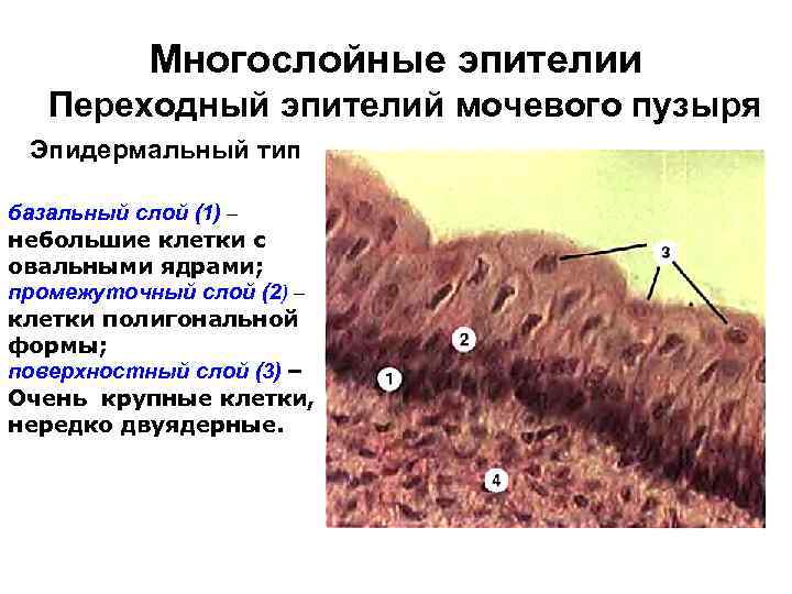 Многослойные эпителии Переходный эпителий мочевого пузыря Эпидермальный тип базальный слой (1) – небольшие клетки