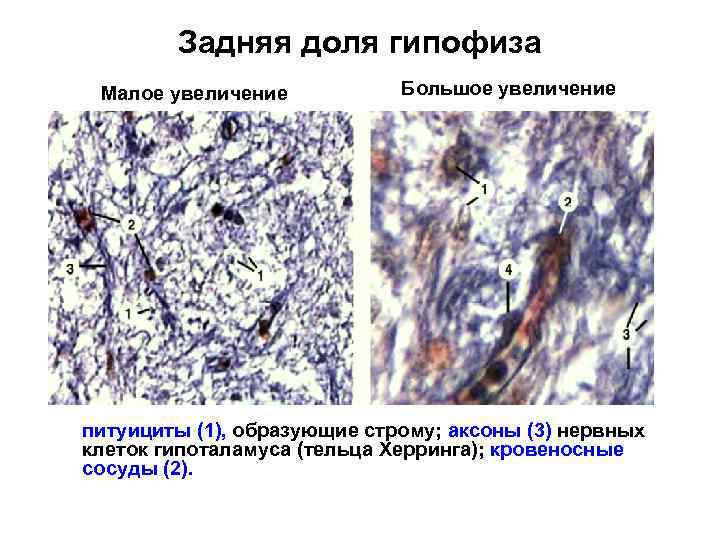 Задняя доля гипофиза Малое увеличение Большое увеличение питуициты (1), образующие строму; аксоны (3) нервных
