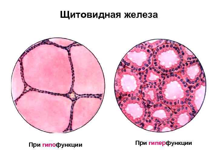 Щитовидная железа При гипофункции При гиперфункции 