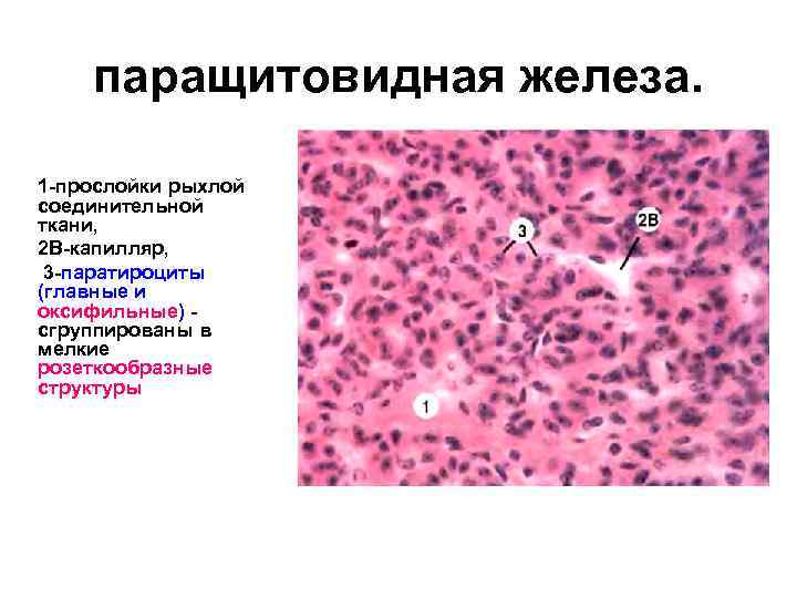 паращитовидная железа. 1 -прослойки рыхлой соединительной ткани, 2 В-капилляр, 3 -паратироциты (главные и оксифильные)