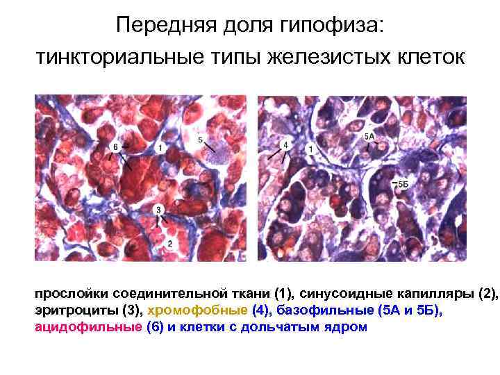Передняя доля гипофиза: тинкториальные типы железистых клеток прослойки соединительной ткани (1), синусоидные капилляры (2),