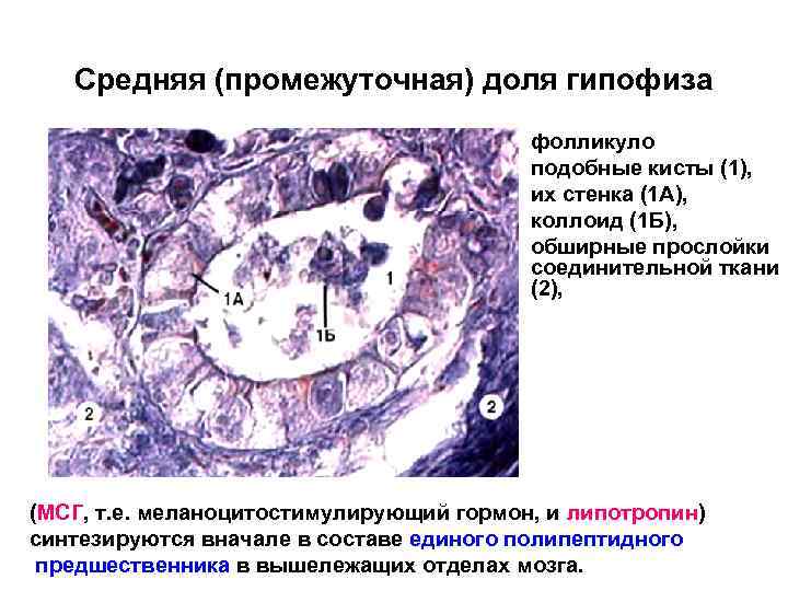 Средняя (промежуточная) доля гипофиза фолликуло подобные кисты (1), их стенка (1 А), коллоид (1