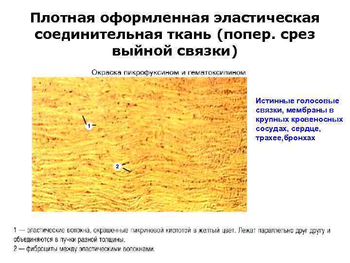 Плотная оформленная эластическая соединительная ткань (попер. срез выйной связки) Истинные голосовые связки, мембраны в