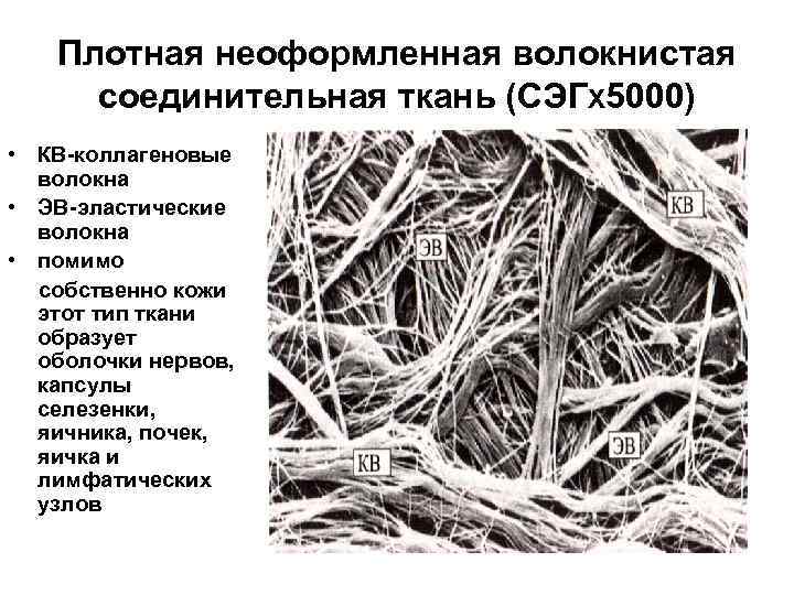 Плотная неоформленная волокнистая соединительная ткань (СЭГΧ 5000) • КВ-коллагеновые волокна • ЭВ-эластические волокна •
