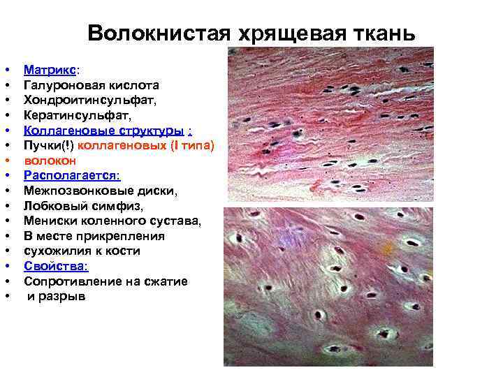 Волокнистая хрящевая ткань • • • • Матрикс: Галуроновая кислота Хондроитинсульфат, Кератинсульфат, Коллагеновые структуры