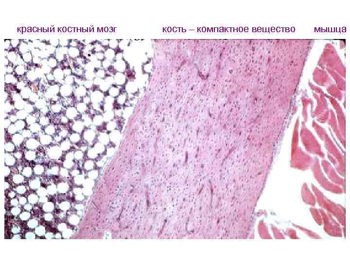 Костный мозг фото. Костный мозг при гипоплазии. Желтый костный мозг гистология. Гипоплазия красного костного мозга. Красный костный мозг пластинчатая кость гистология.
