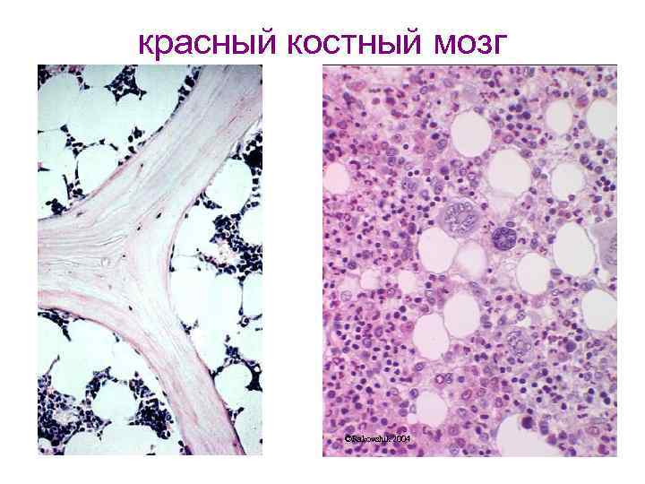 красный костный мозг ©Rakovshik 2004 