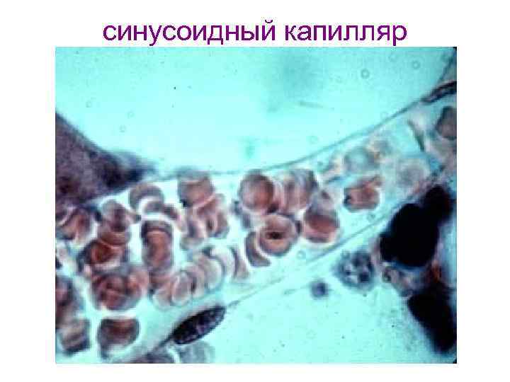 синусоидный капилляр 