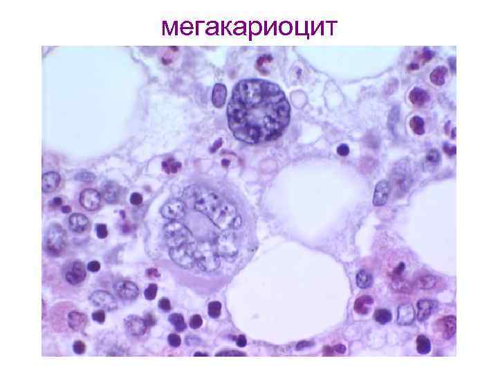мегакариоцит 