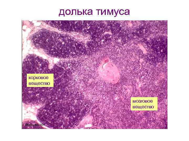 долька тимуса корковое вещество мозговое вещество ©Rakovshik 2004 
