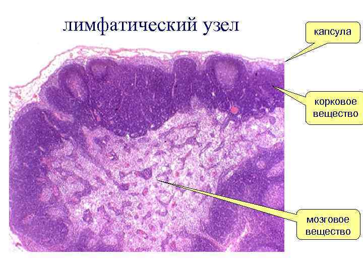 лимфатический узел капсула корковое вещество мозговое вещество 