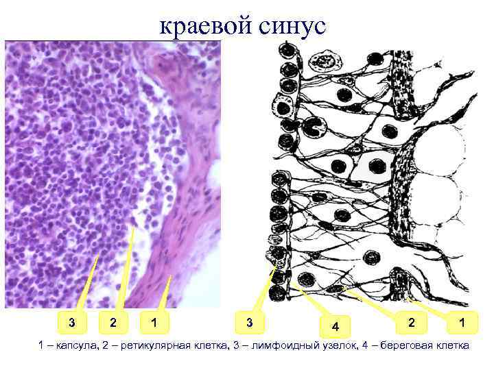 краевой синус 3 2 1 3 4 2 1 1 – капсула, 2 –
