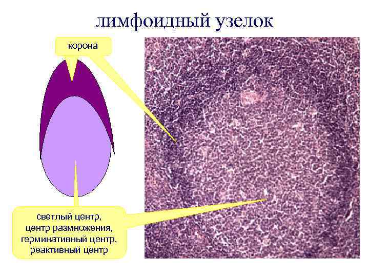 лимфоидный узелок корона светлый центр, центр размножения, герминативный центр, реактивный центр 