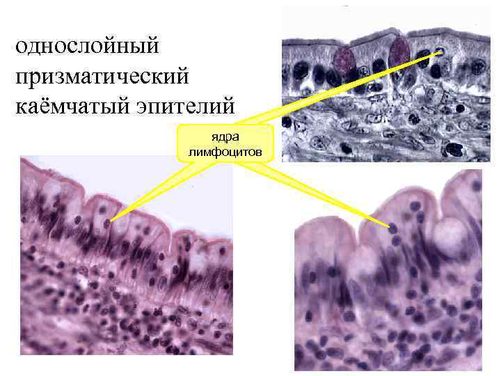 однослойный призматический каёмчатый эпителий лимфоидные ядра лимфоцитов узелки 