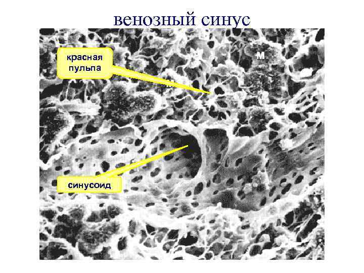венозный синус красная пульпа синусоид 