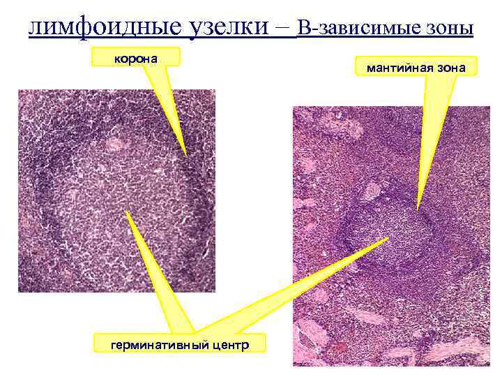 лимфоидные узелки – В-зависимые зоны корона герминативный центр 1 мантийная зона 