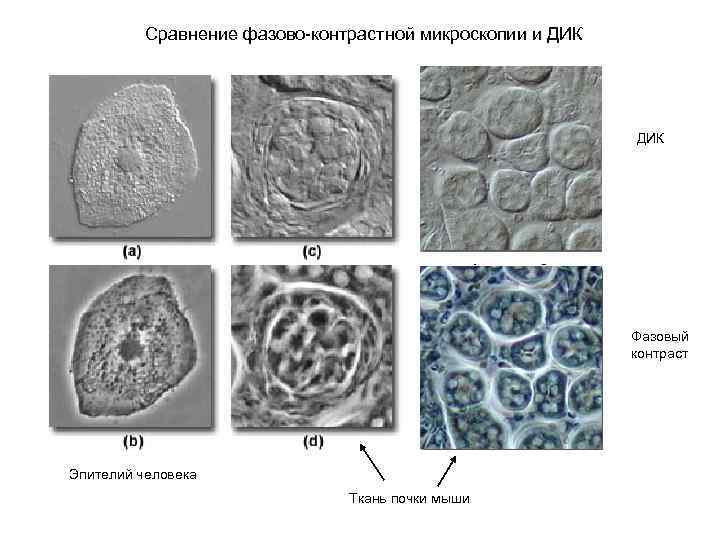 Фазово контрастная микроскопия