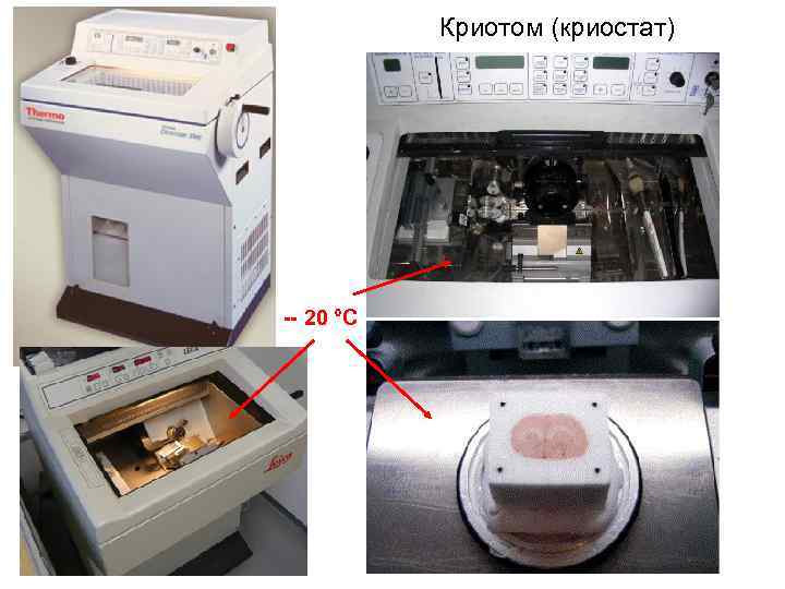 Криотом (криостат) -- 20 °С 