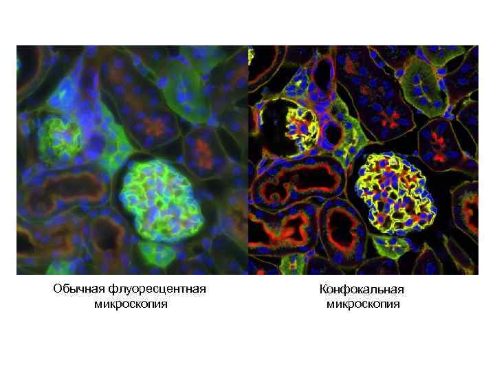 Обычная флуоресцентная микроскопия Конфокальная микроскопия 