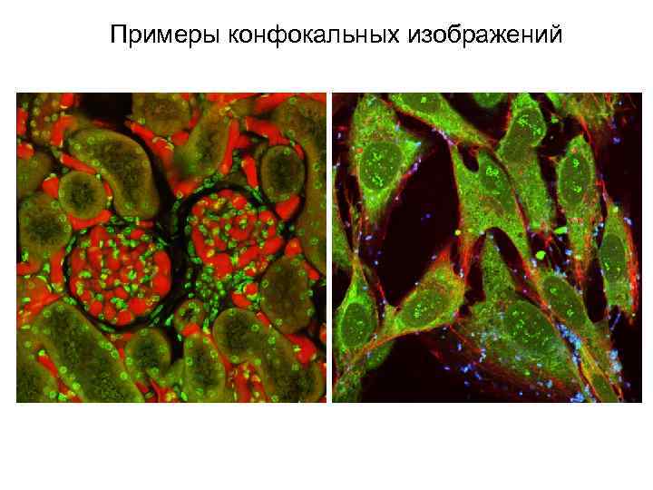 Примеры конфокальных изображений 