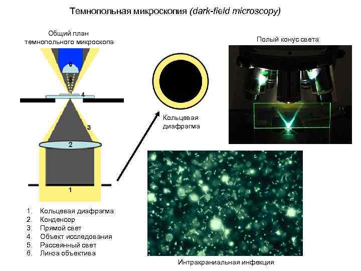 Поле микроскопа. Ход лучей в темнопольном микроскопе. Принципы микроскопии в темном поле зрения. Метод темного поля в микроскопии. Схема темнопольной микроскопии.