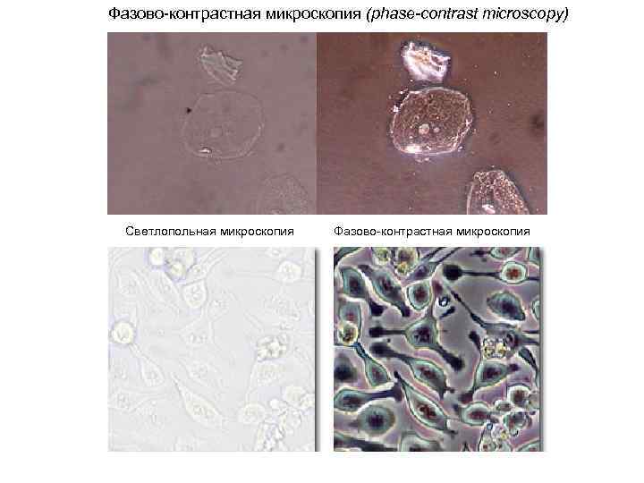 Фазово-контрастная микроскопия (phase-contrast microscopy) Светлопольная микроскопия Фазово-контрастная микроскопия 