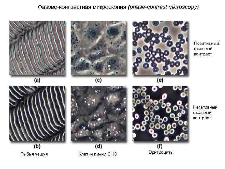 Методы контрастирования изображения