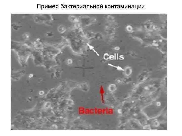 Пример бактериальной контаминации 